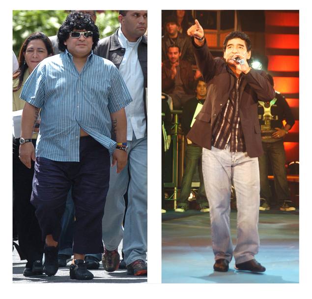 Nel 2005 Maradona era dovuto ricorrere ad un intervento chirurgico per la riduzione del peso. Eccolo nella foto prima e dopo l&#39;operazione